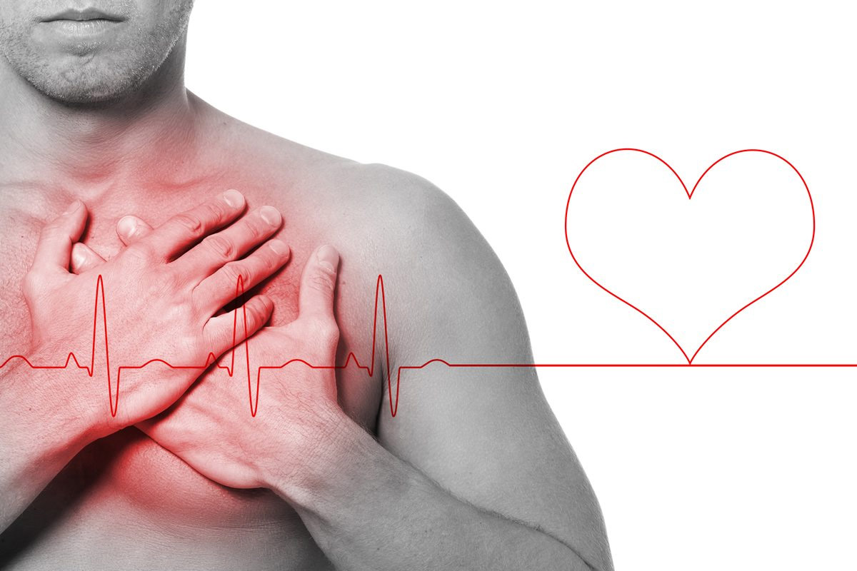 Attacco cardiaco: cos’è e come riconoscerlo