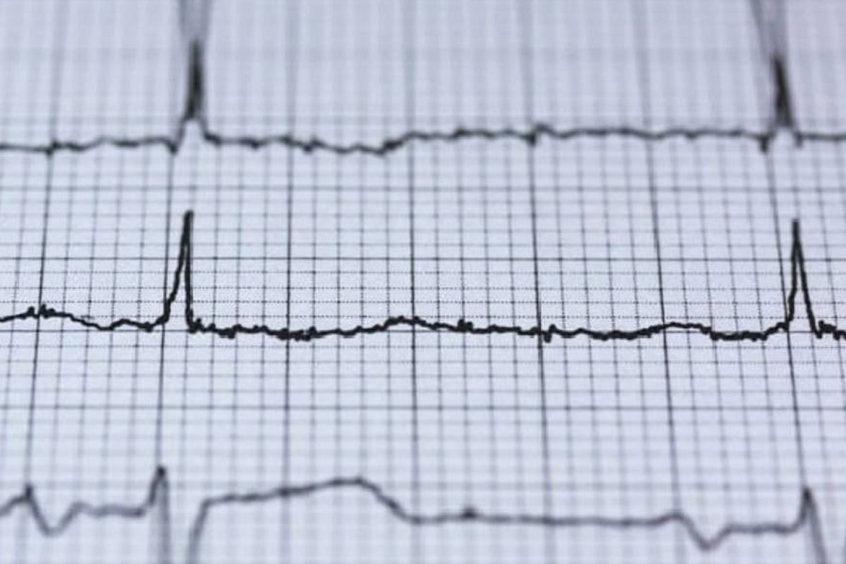 Terapia “curativa” della fibrillazione atriale